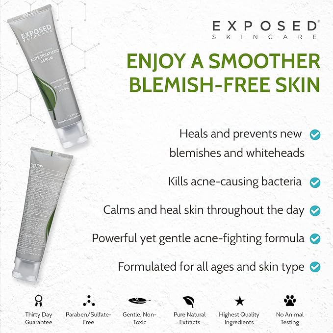 Exposed Skin Care Acne Treatment Serum Step 3 – Quickly Reduces Pimple Size and Redness - 12 Hour Spot Treatment - 3.5% Benzoyl Peroxide, Natural Green Tea & Tea Tree Oil-GlimoraGlow