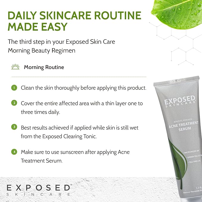 Exposed Skin Care Acne Treatment Serum Step 3 – Quickly Reduces Pimple Size and Redness - 12 Hour Spot Treatment - 3.5% Benzoyl Peroxide, Natural Green Tea & Tea Tree Oil-GlimoraGlow