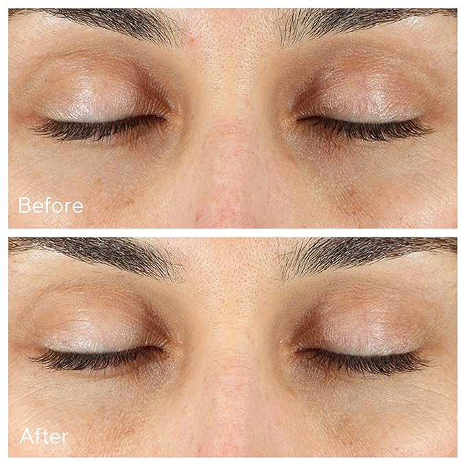 Murad Vita-C Eyes Dark Circle Corrector – Environmental Shield Vitamin C Brightening Serum – Anti-Aging Treatment for Puffiness and Wrinkles, 0.5 Fl Oz-GlimoraGlow