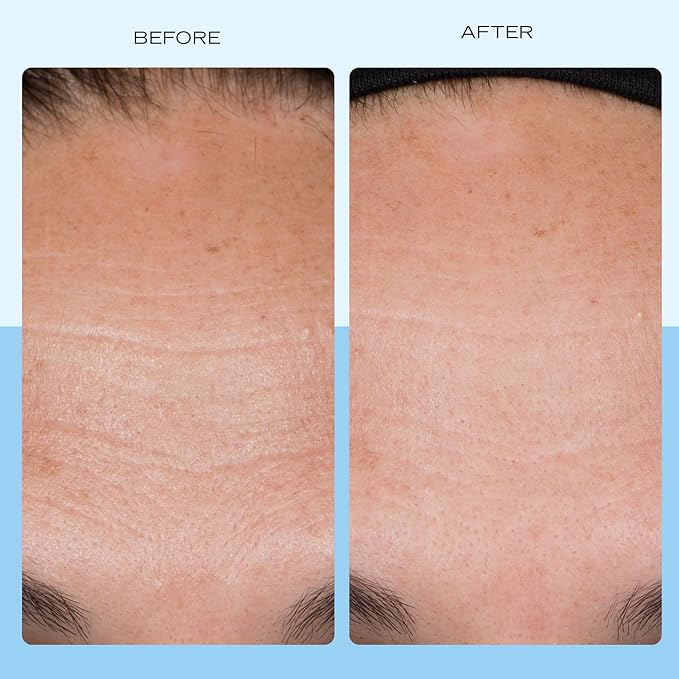 First Aid Beauty Firming Collagen Cream with Collagen, Peptides and Niacinamide – Day + Night Anti-Aging Face Moisturizer – 1.7 fl oz-GlimoraGlow