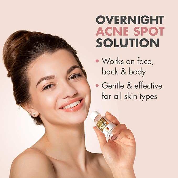 Ebanel Acne Spot Drying Lotion for Face & Body with Sulfur & Salicylic Acid, Targets Pimples & Zits, Helps Clear Pores and Reduce Surface Blemishes Overnight-GlimoraGlow