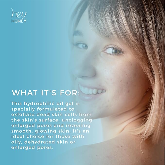 Hey Honey Skincare Be Clear - Acne Control Deep Pores Cleansing Gel | Propolis, Green Tea Oil, Camellia | Exfoliates, Unclogs Pores, Balances Oil Production | Fast Acting & Long Lasting | 2.7 Oz-GlimoraGlow