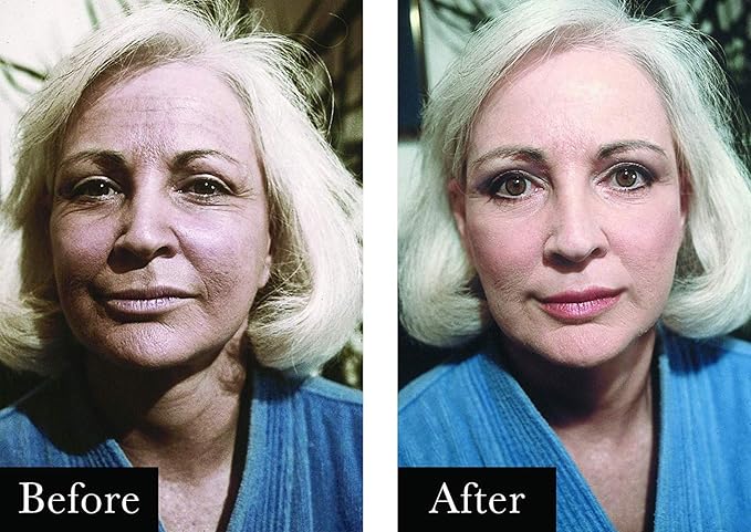 Boyd's Renoir No Lines Temporary Wrinkle Remover- For Forehead, Eyes, Lips, 0.5 fl oz (5-Pack)-GlimoraGlow