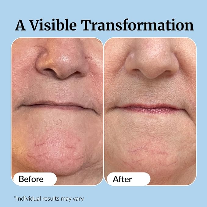 Vibriance Super C Serum for Mature Skin - All-in-One Vitamin Formula Hydrates, Firms, Lifts, Smooths, Targets Age Spots, Wrinkles, 1 fl oz - Pack of 3-GlimoraGlow