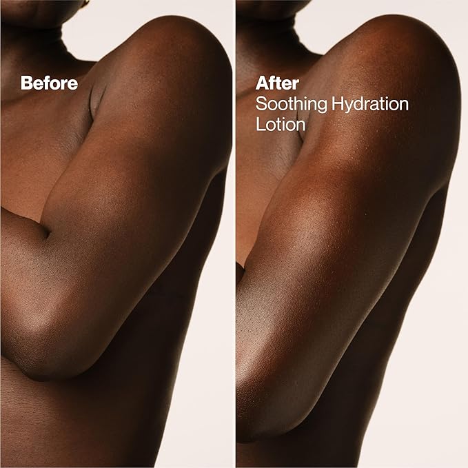 Suave Soothing Hydration Hand & Body Lotion With Aloe Vera Refreshes Dry Skin, Fast Absorbing, Intensive Moisturizing Cream For Women, Non Greasy, Allergen Free, 18 FL OZ, 6 Pack-GlimoraGlow