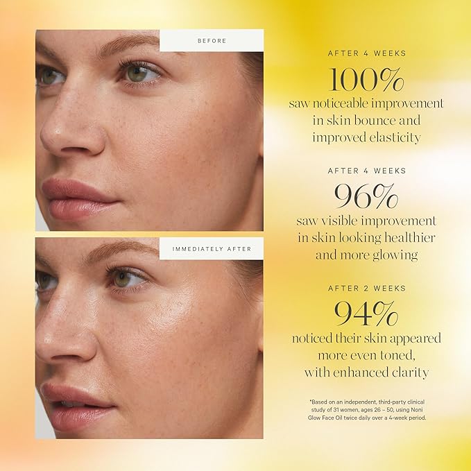 KORA Organics Noni Glow Hydrating Face Oil for Women with Rosehip, Gua Sha Oil, Certified Organic, Cruelty Free, 1.69 fl oz-GlimoraGlow