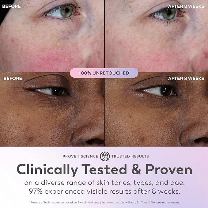 Olay Super Serum - Niacinamide, Vitamin C & E, Collagen Peptide, AHA - 5-in-1 Skin Care Benefits for Face - Healthy Glow, Brightening, Hydrating, Smoothing, Firming, Evens Tone, Anti-Aging, 1.7 Oz-GlimoraGlow