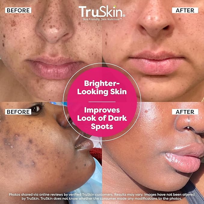 TruSkin Vitamin C Super Serum - Niacinamide, Retinol, Hyaluronic & Salicylic Acid - All-in-One Anti Aging Serum for Face – Improve Appearance of Dark Spots, Firmness for Brighter Looking Skin, 1 Fl Oz-GlimoraGlow