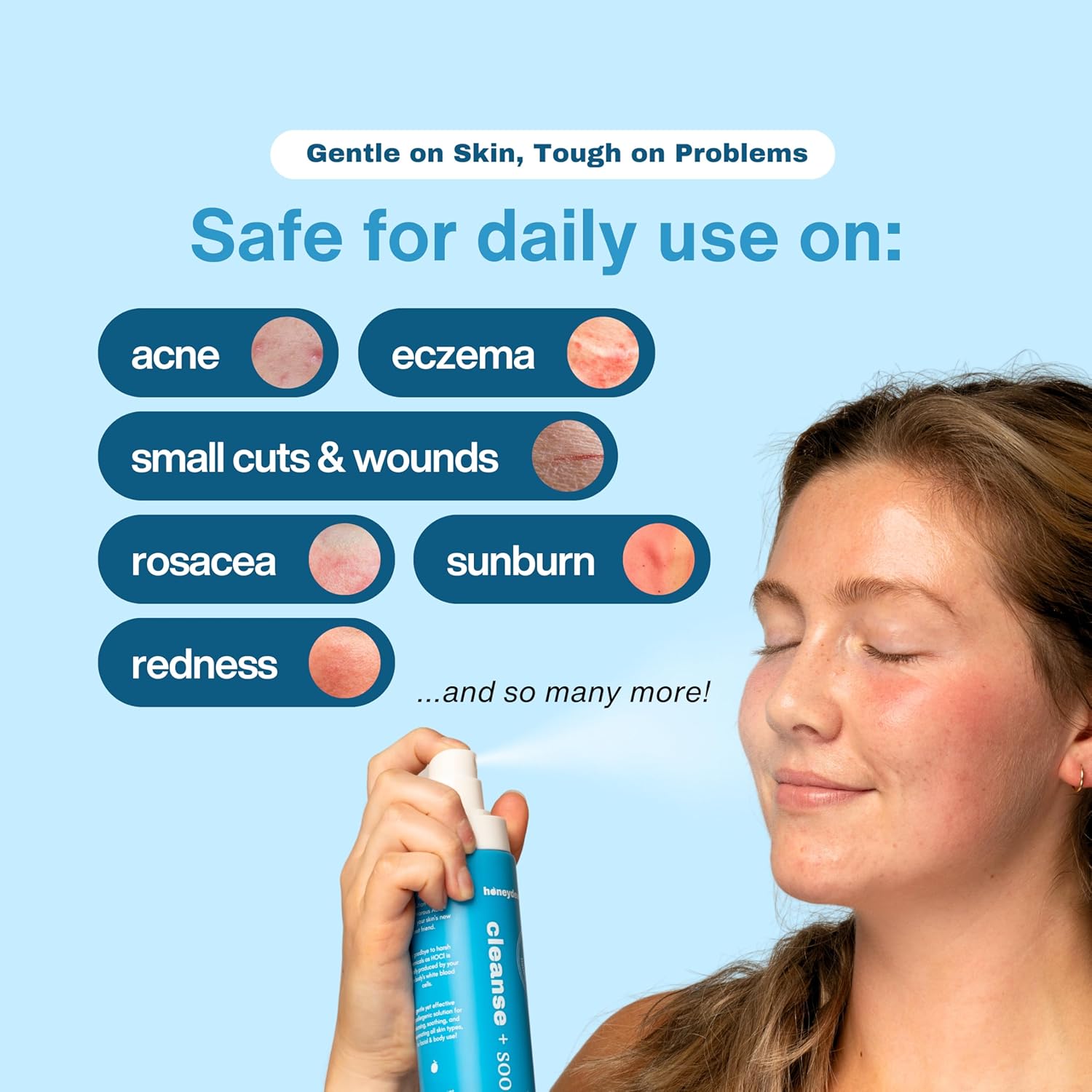 Hypochlorous Acid Spray - HOCL - Hypoallergenic Skin Toner Cleanse and Soothe Sensitive Face - Acne - Eczema - Bacne - Eyelid - Pre Post Workout (Mini Bundle Pack - 2fl + 2 fl)-GlimoraGlow