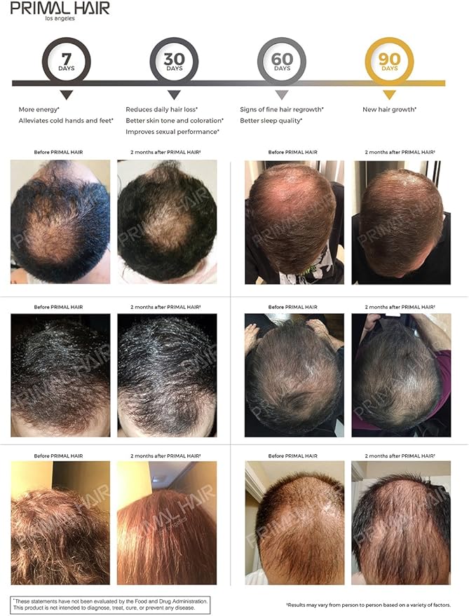 100% Natural Growth Treatment, Reduces Hair Loss, US Patented Formula Proven Effective for Men & Women, 100% Vegan Ingredients, Non-GMO, 30-Day Supply-GlimoraGlow