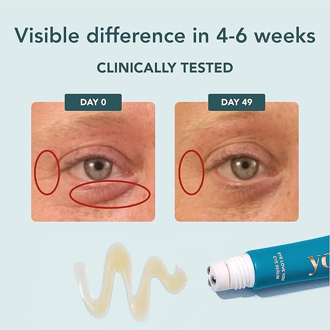 YOURS Eye Serum with Caffeine & Antioxidants | Hydrates and Brightens Under Eye Area | Restores Skin Firmness and Reduces Appearance of Fine Lines-GlimoraGlow