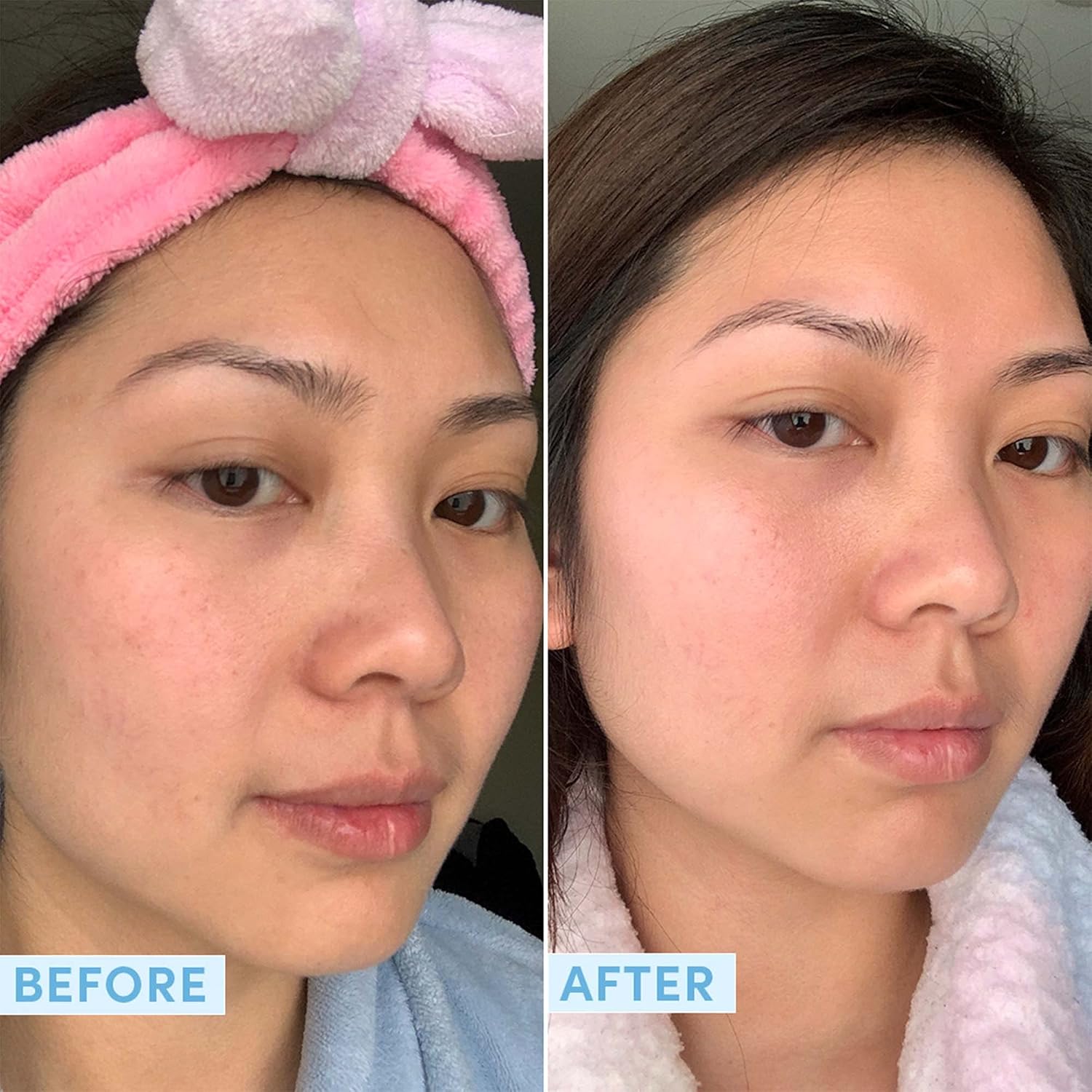 Sand & Sky Tasmanian Spring Water Hydrating Serum with Hyaluronic Acid & Probiotics - Fine Line Reducing Face Serum, Plumps Skin & Smooths Wrinkles, 1 fl oz-GlimoraGlow