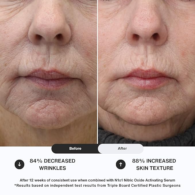 Moisturizer Face Cream - Day & Night Face Moisturizer with Nitric Oxide, Peptide Complex, Epidermal Growth Factor - Tightening & Firming Skin Care Products for Wrinkles, Dark Spots - 1.75 oz.-GlimoraGlow