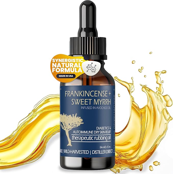 BALM OF GILEAD Neuropathy Frankincense & Sweet Myrrh Therapeutic Rubbing Oil - Instant Diabetic's & Autoimmune Dry Skin Relief & Repair, 2 fl oz-GlimoraGlow