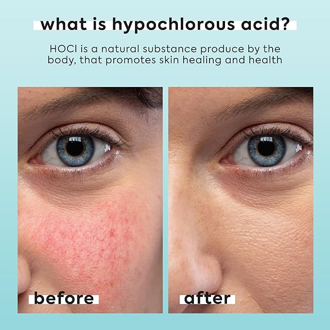 Hypochlorous Acid Spray for Face & Body - Helps Reduce Redness and Breakouts - Travel Size Hypochlorous Spray, Multi-Purpose Topical Facial Skin Repair, pH-Balancing Toner - TSA, Livaclean-GlimoraGlow
