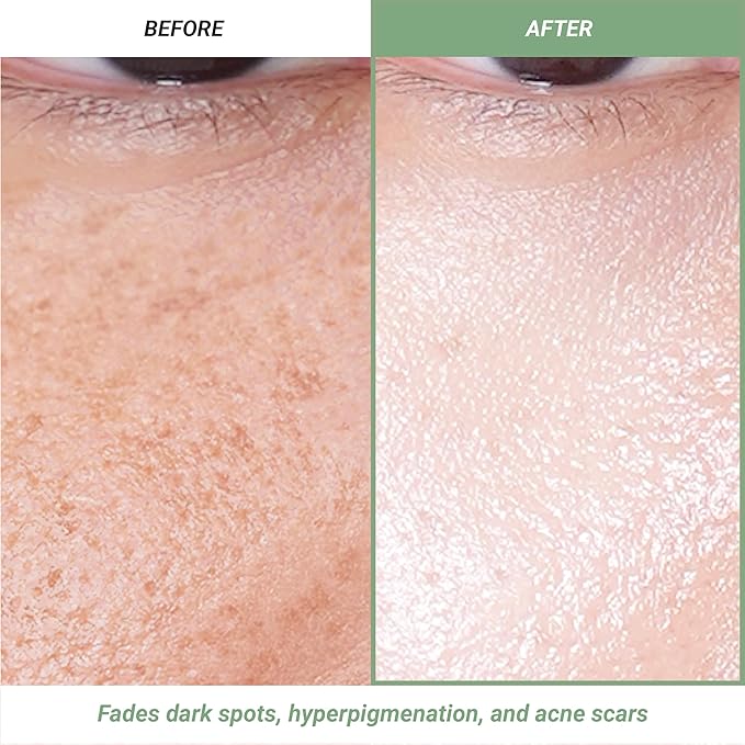 Meebak Korean Vitamin C Serum | Brightening Dark Spot Remover | Soothing Anti Aging & Skin Brightening w/Centella Asiatica, Panthenol, & Adenosine-GlimoraGlow