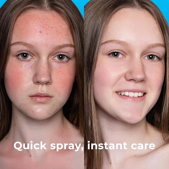 Hypochlorous Acid Spray (8oz, 2 packs), HOCL Facial Cleanser Acne Spray for Face, Body, Eczema, Pimples, Breakouts & Overall Skin Recovery (Reduces Redness)-GlimoraGlow