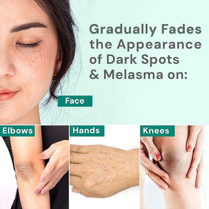 Ebanel Dark Spot Remover for Face & Body, Skin Brightening Cream with Synovea, Alpha Arbutin, Niacinamide, Kojic Acid, Dark Spot Corrector for Hyperpigmentation, Discoloration, Melasma, and Age Spots-GlimoraGlow