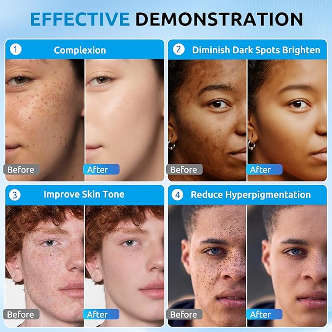 HANYWIL Dark Spot Corrector Cream for Hyperpigmentation,Brightening Serum for Face & Body,Rapid Fade Treatment for Sun Spots, Age Spots & Melasma,Dermatologist-Tested Skin Tone Evenser (2.0 Fl Oz)-GlimoraGlow