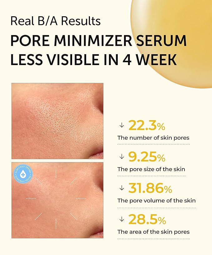 SERUMKIND Pore tightening and Refining Serum Korean Face Skincare - Natural Salicylic acid - Yellowmello Extract 92% -1 fl.oz.-GlimoraGlow