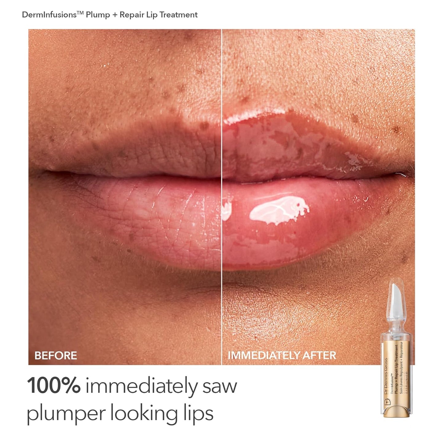 Dr. Dennis Gross Fill, Plump & Firm Kit – DermInfusions™ Hyaluronic Acid Serum, Eye Cream & Lip Treatment | Boost Hydration, Smooth Fine Lines & Enhance Volume | Limited Edition Gift Set-GlimoraGlow