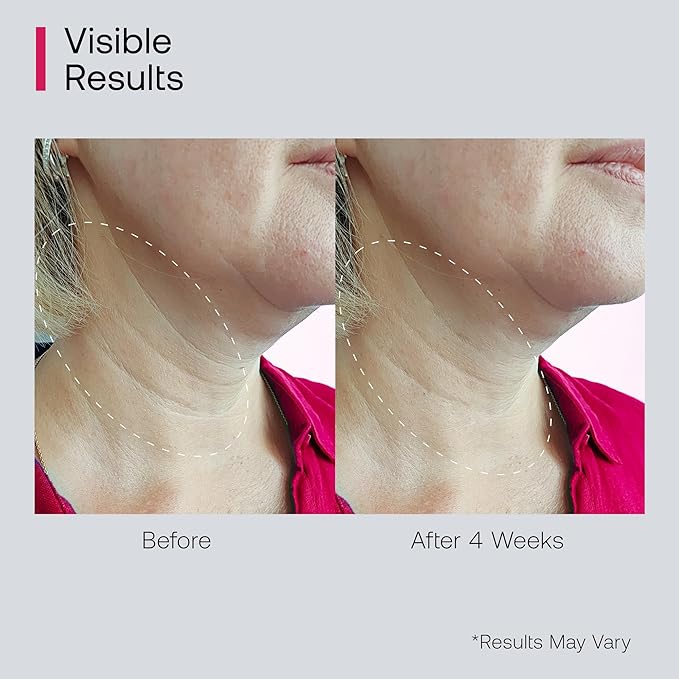 Retinol Neck Firming Cream with Cooling & Massaging Roller Applicator - Hydrates, Lifts, Smoothes Wrinkles, Fine Lines & Tightens Sagging Skin with Niacinamide & Hyaluronic Acid, 1.7oz/50g-GlimoraGlow