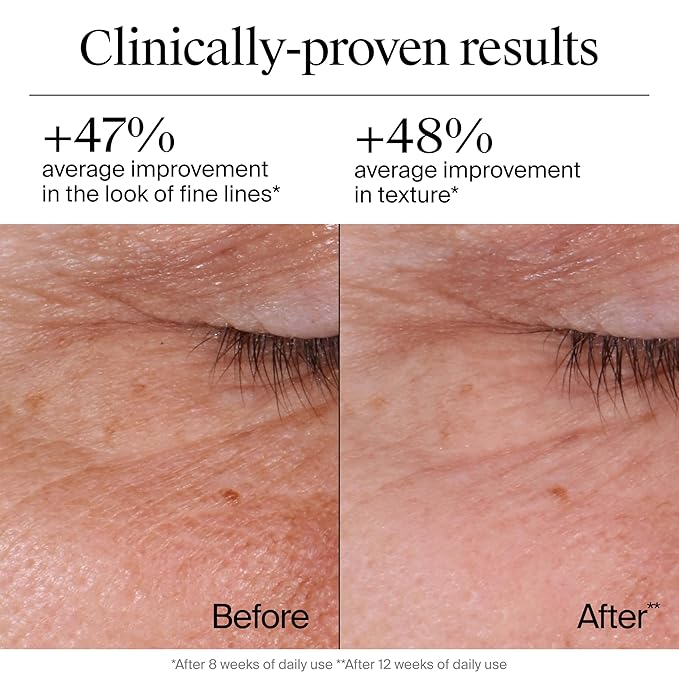 Neutrogena Rapid Wrinkle Repair Retinol Face Moisturizer, Daily Anti-Aging Face Cream with Retinol & Hyaluronic Acid to Fight Fine Lines, Wrinkles, & Dark Spots, 1.7 oz-GlimoraGlow