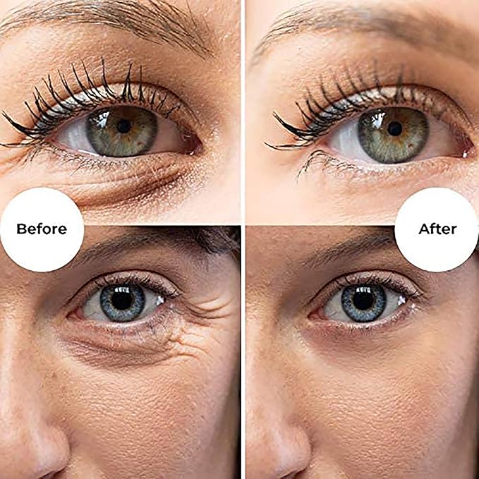 Gle Vitamin C Eye Serum for Dark Circles, Eye Wrinkles, Redness and Puffy Eyes | Anti-Aging Treatment with Caffeine, Vitamin C Hyaluronic Acid | Hydrating & Brightening Scent-Free | (Pack of 2)-GlimoraGlow