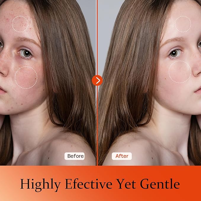 Vitamin C Serum For Face-Anti Aging & Wrinkle Facial Serum With Vitamin C,Sodium Hyaluronate,Vitamin E And More,Skin Brightening Serum For Dark Spots,Fine Lines & Dull Skin,1 Fl Oz-GlimoraGlow