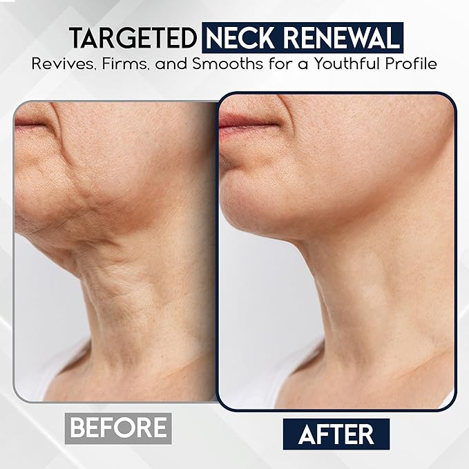 Neck Creams for Tightening and Firming Sagging Skin - Skin Tightening Cream for Face - Decollete & Chest, Under Chin Firming for Older Women - Neck Wrinkles Treatment with Collagen & Hyaluronic Acid-GlimoraGlow