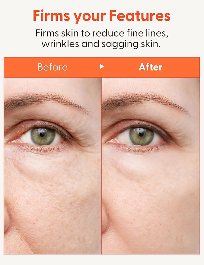 It'S SKIN Collagen Nutrition Serum, Intense Lifting & Anti-Wrinkle Serum with Marine Collagen, Anti-Aging & Moisturizing Serum, Improves Elasticity, 1.35 fl.oz.-GlimoraGlow