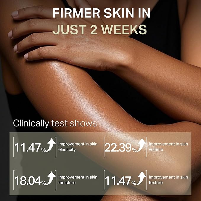Ultra-Size Firming Retinol Body Lotion for Crepey Skin & Keratosis Pilaris with 0.05% Retinol, AHA, Collagen, Body Cream, Anti Aging Moisturizer 10.14 fl oz-GlimoraGlow