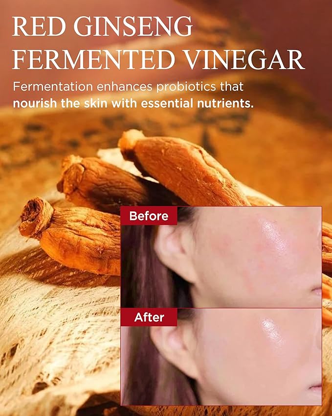 Bonyongo Red Ginseng Vinegar Essence– Revitalizing & Intensive Nourishing for All Skin Types - Hydrated and Glowing Skin with Fermented Red Ginseng - Korean Skincare, 1.5 fl.oz.-GlimoraGlow