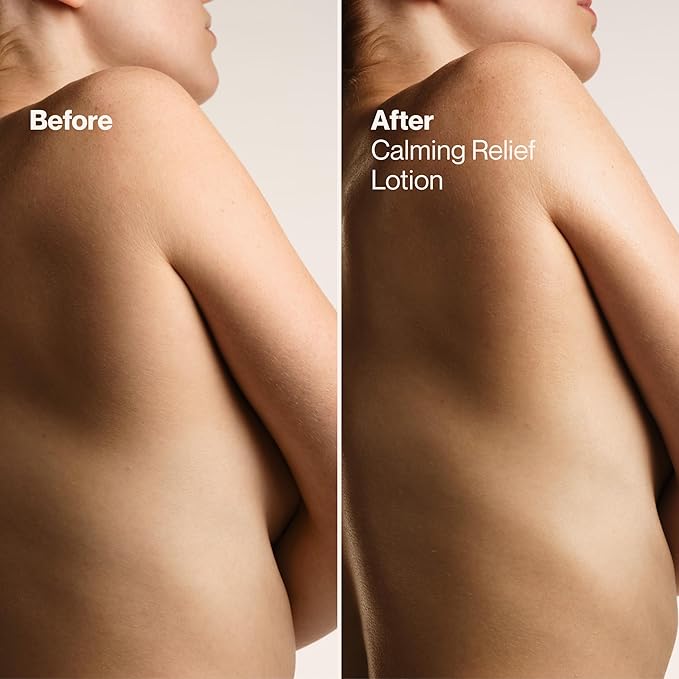 Suave Calming Relief Hand & Body Lotion for Women With Prebiotics For Sensitive Skin, Fragrance & Allergen Free, Helps Restore Skin's Moisture Barrier, 18 FL OZ, 6 Pack-GlimoraGlow