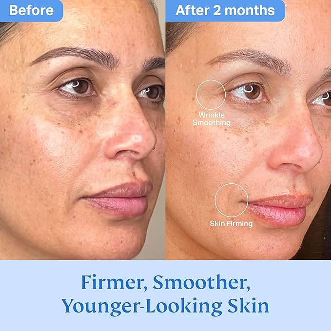 HYDRONOVA Total Rewind Sculpting Serum 1 fl oz | Line-Smoothing, Dark Spot Corrector | Vitamin C, Niacinamide, Kojic Acid, Peptides | Radiant Glow, Balanced Complexion | AM Formula-GlimoraGlow