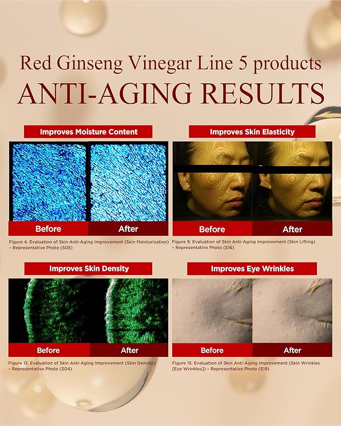 Bonyongo Red Ginseng Vinegar Essence– Revitalizing & Intensive Nourishing for All Skin Types - Hydrated and Glowing Skin with Fermented Red Ginseng - Korean Skincare, 1.5 fl.oz.-GlimoraGlow