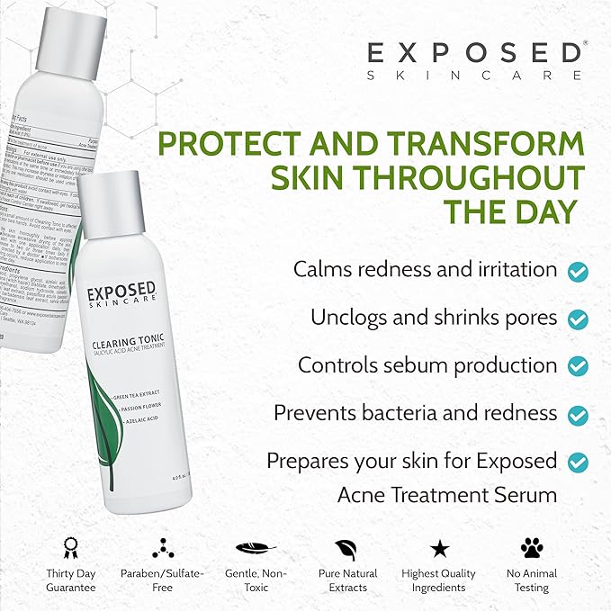 Exposed Skin Care Clearing Tonic Facial Toner with 1% Salicylic Acid and Witch Hazel for Acne Treatment – Pore Minimizing Toner to Prevent Breakouts, Reduce Redness and Balance Skin – Step 2 (4 fl oz)-GlimoraGlow