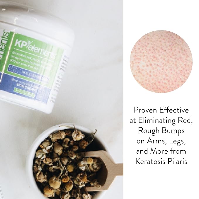 KP Elements Keratosis Pilaris Lotion (4 fl oz) - Natural Keratosis Pilaris Treatment, Moisturizing & Exfoliating AHA Lotion for KP, Vegan, Made in USA-GlimoraGlow