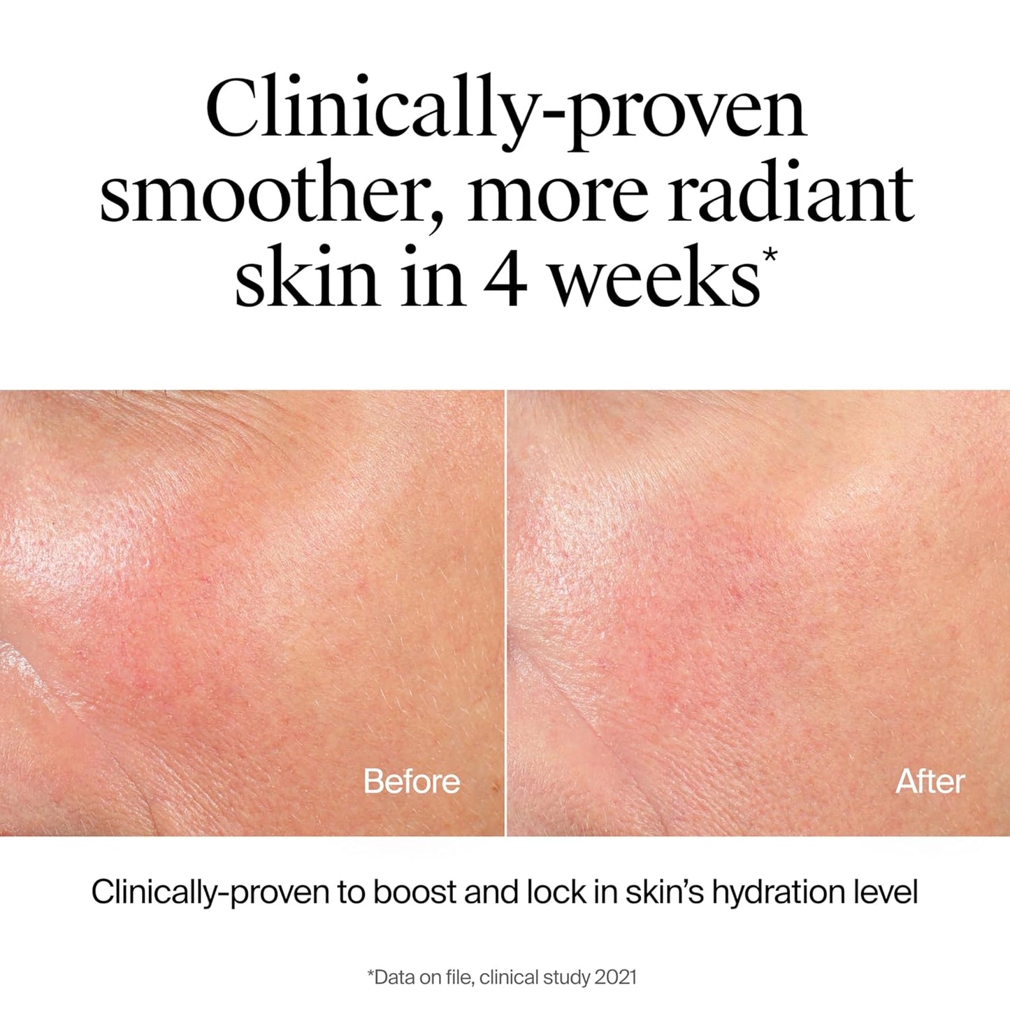 Neutrogena Hydro Boost Hydrating Face Wash & Makeup Remover, Gentle Facial Cleanser Gel with Hyaluronic Acid, Locks Moisture for Soft Supple Skin, Hypoallergenic, Oil-Free, Soap-Free, 7.8 fl oz-GlimoraGlow