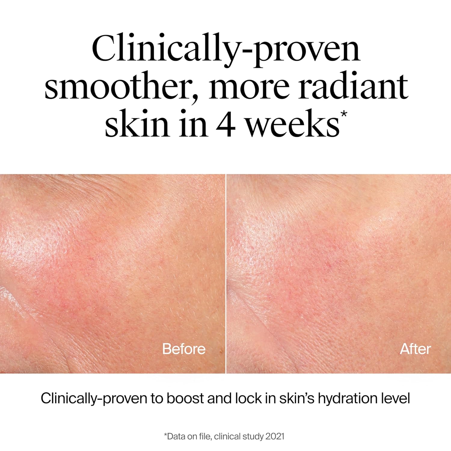 Neutrogena Hydro Boost Hydrating Face Wash & Makeup Remover, Gentle Facial Cleanser Gel with Hyaluronic Acid, Locks Moisture for Soft Supple Skin, Hypoallergenic, Oil-Free, Soap-Free, 7.8 fl oz-GlimoraGlow