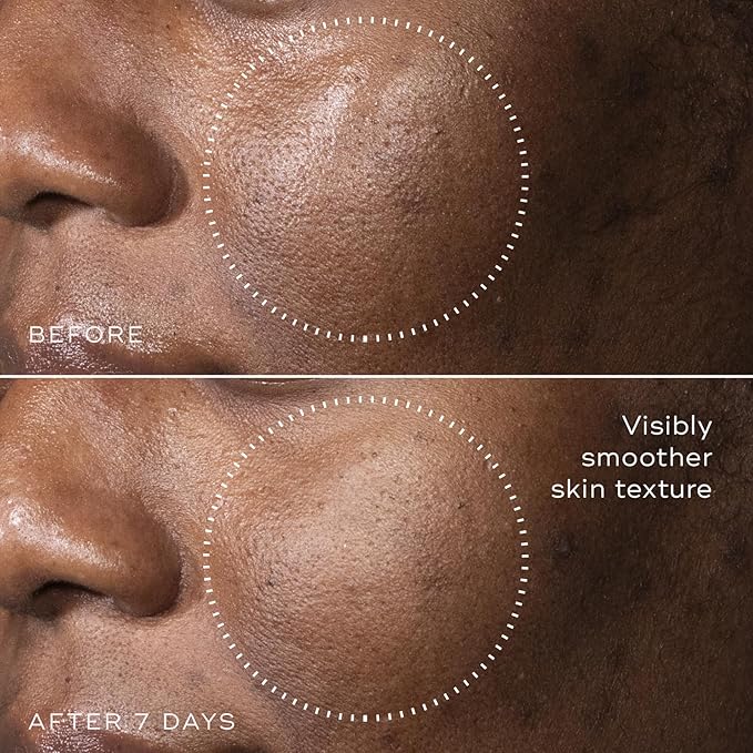 Medik8 C-Tetra Advanced - Balancing, Plumping, Hydrating Daily Vitamin C Serum with Hyaluronic Acid, Squalene - Smooths Fine Lines, Wrinkles - 1.0 oz-GlimoraGlow