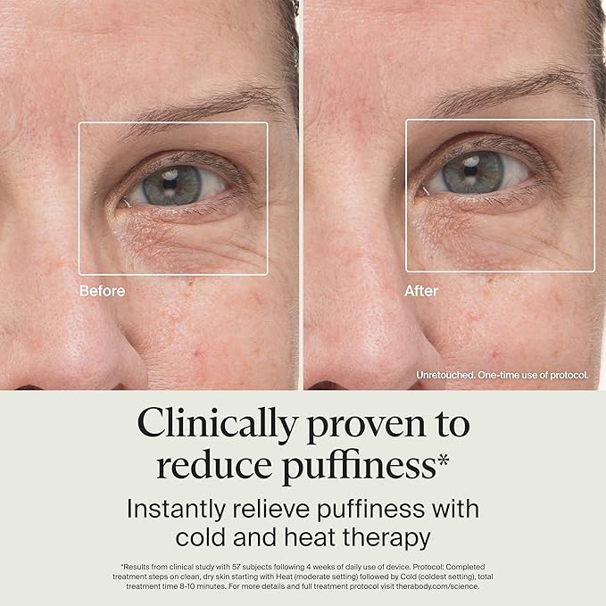 Therabody TheraFace Depuffing Wand – Cold and Heat Skincare Treatment to Depuff and Glow; Beauty Wand, Face Roller and Eye Massager for Eye Puffiness, Dark Circles and Skin Radiance (White)-GlimoraGlow