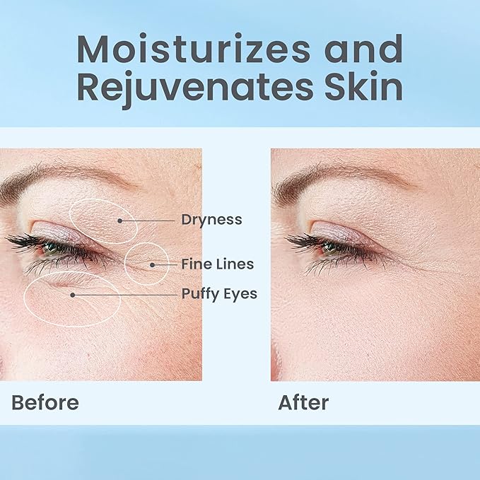 Hydrate& Replenish EYE CREAM- Gel Hydrator-Cream with Hyaluronic Acid & Marine Extracts, attracts moisture to the skin Algae And Seaweed Extracts to revitalize dull looking skin 0.5 Oz-GlimoraGlow