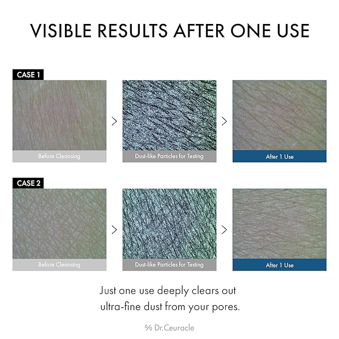 Dr.Ceuracle Pro Balance Enzyme Powder Face Wash - Korean Day and Night Natural Enzyme Powder Face Wash for Deep Pore Cleansing, Sebum Removing, pH Skin Balancing Care (Night Wash)-GlimoraGlow