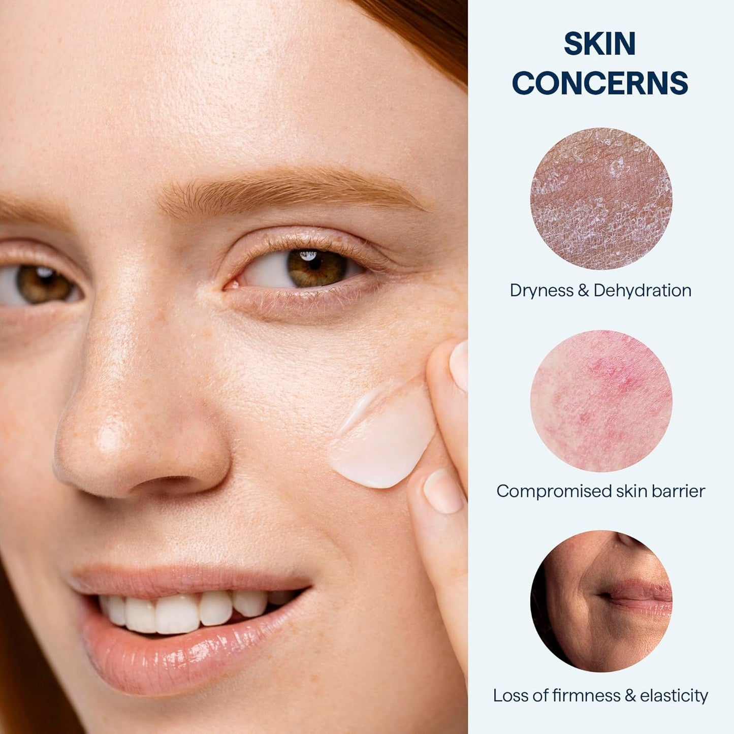 Remedy for Rich Moisture - Barrier Repairing Rich Cream Moisturizer for Normal to Dry Skin - Quadruple Ceramide Complex, Peptides, Squalane, Glycerin- By Dermatologist Dr. Shah, 1.7 fl. oz-GlimoraGlow