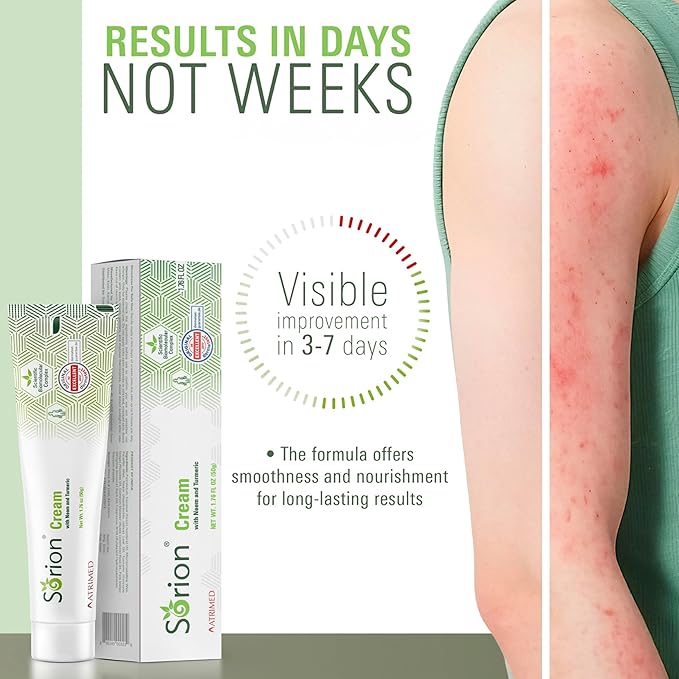 Sorion Cream - Herbal Moisturizer for Dry, Itchy, Flaky Skin with Coconut Oil, Neem, Turmeric and Pala Indigo Plant Skincare-GlimoraGlow