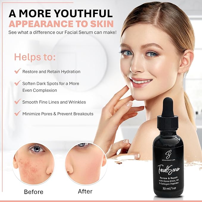 Facial Serum - Fight Blemishes - Acne Pimples & Breakouts - Soften Fine Lines & Wrinkles - Hydrate & Repair Damaged Skin - Clear Complexion - Collagen - 2 Types of Hyaluronic Acid - Anti Aging - 1oz-GlimoraGlow