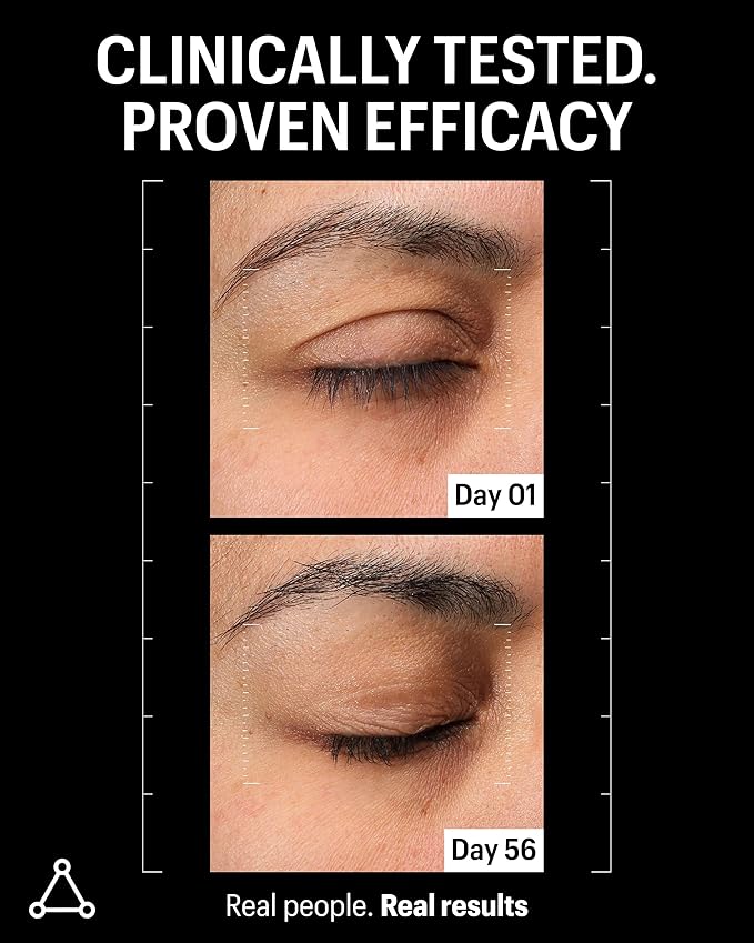 Allies of Skin Multi Peptides & Growth Factor Collagen Boosting Face Serum | Skin Tightening Anti-Aging Complex with 9% Peptides| Firms Sagging Skin & Visibly Reduces Wrinkles (1 oz)-GlimoraGlow