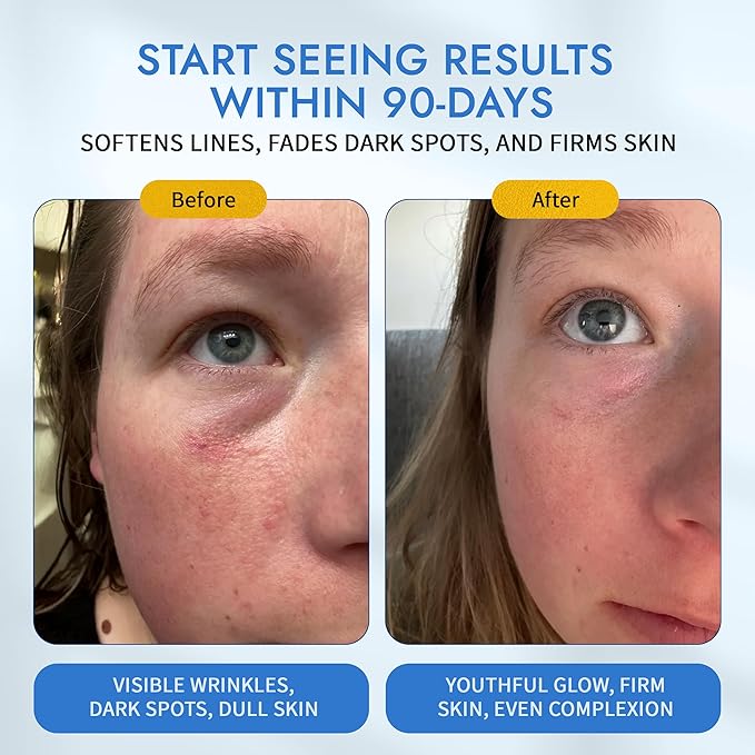 MAELOVE Moonlight Advanced Retinal Super Serum, 10x Stronger than Regular Retinol, for Softening Lines and Wrinkles, Reducing Dark Spots, Improving Skin Firmness, Vegan, Cruelty-Free, 1.0 fl oz-GlimoraGlow