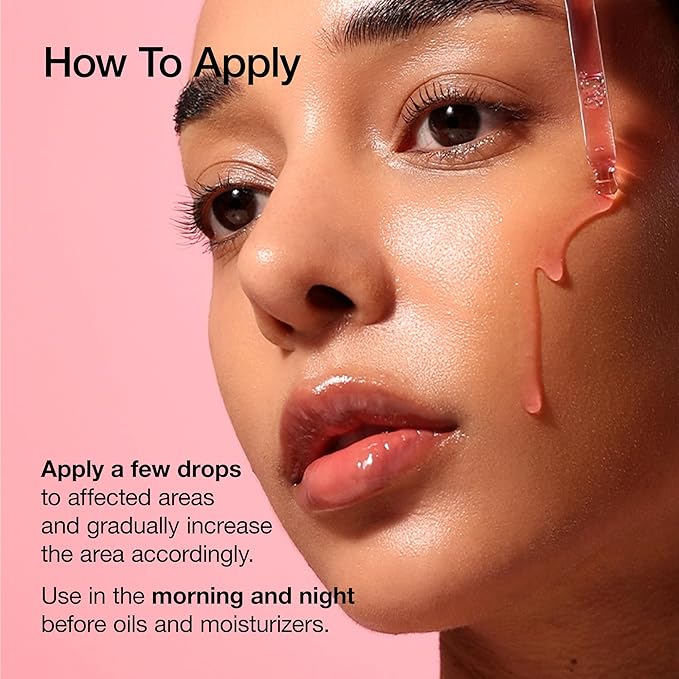 ANUA Niacinamide 10 + TXA 4 Serum, Hyaluronic Acid, Tranexamic acid, Facial Serum for Glass Skin, Clarifying, Radiant Complexion with Natural Color, Korean Skin Care (30ml /1.01 fl.oz)-GlimoraGlow